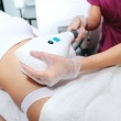 Get Your Summer Body With CoolSculpting® Elite