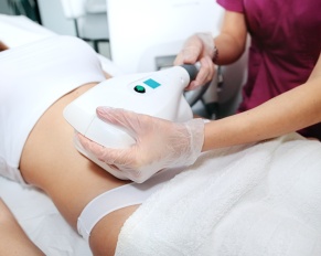 woman getting coolsculpting treatment