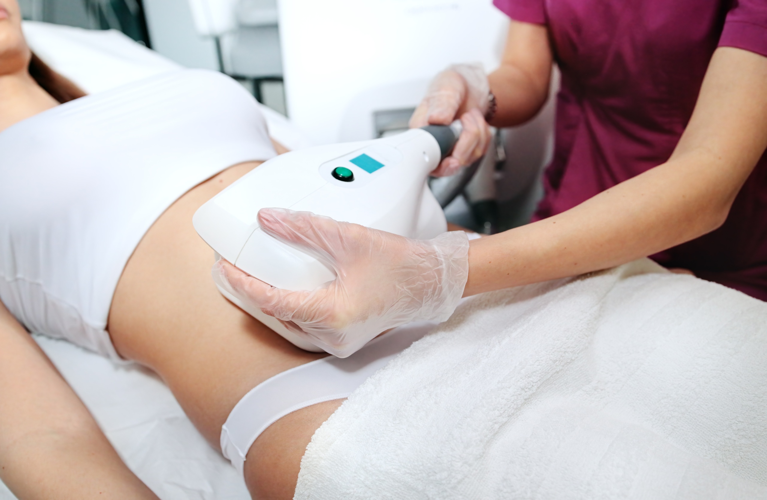 woman getting coolsculpting treatment