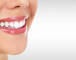 woman with cosmetic dentistry smiling with teeth whitening