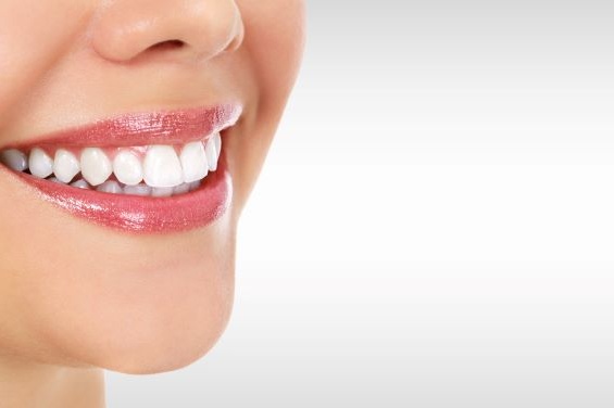 woman with cosmetic dentistry smiling with teeth whitening