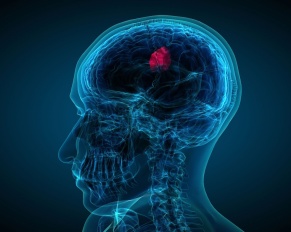 Brain Tumor and Skull Base Surgery